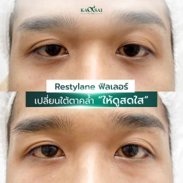 รีวิววววววว