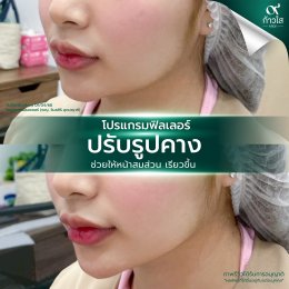 รีวิววววววว