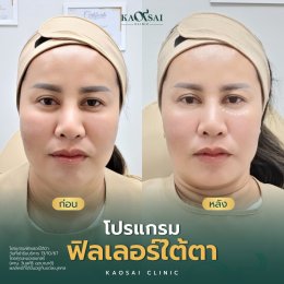 รีวิววววววว