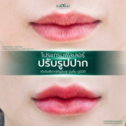 รีวิววววววว