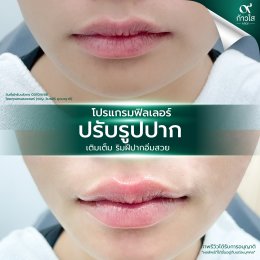 รีวิววววววว