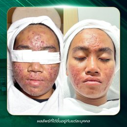 รีวิววววววว