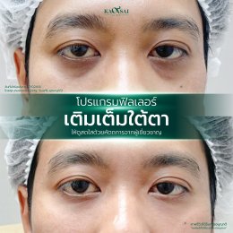 รีวิววววววว