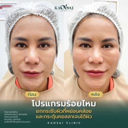 รีวิววววววว
