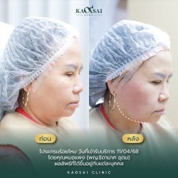 รีวิววววววว