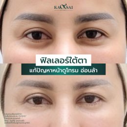 รีวิววววววว