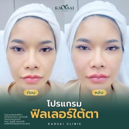 รีวิววววววว
