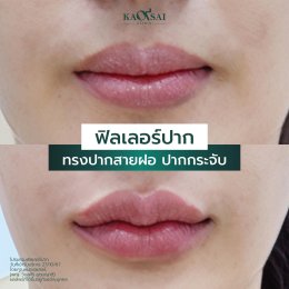 รีวิววววววว