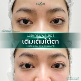 รีวิววววววว