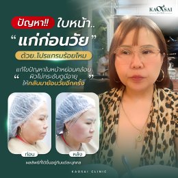 รีวิววววววว