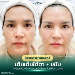 รีวิววววววว