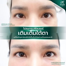 รีวิววววววว