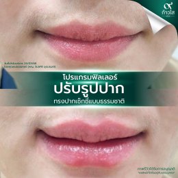 รีวิววววววว