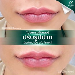 รีวิววววววว