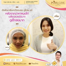 Fresh Cell หน้าเด็ก