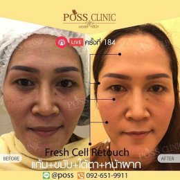 Fresh Cell หน้าเด็ก