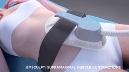 นวัตกรรมสร้างกล้ามเนื้อสลายไขมันด้วย Emsculpt