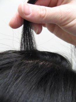 ผมร่วงทั่วศีรษะ (Telogen Effluvium) คืออะไร รักษาได้อย่างไร?