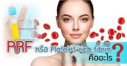 PRF หรือ Platelet-rich fibrin คืออะไร ?