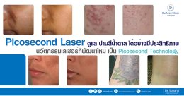 Picosecond Laser ดูแล ปานสีน้ำตาล ได้อย่างมีประสิทธิภาพ นวัตกรรมเลเซอร์ที่พัฒนาใหม่ เป็น Picosecond Technology
