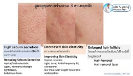 รูขุมขนกว้าง Enlarged Facial Pore ดูแลได้อย่างไร Part II?