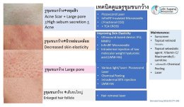 รูขุมขนกว้าง Enlarged Facial Pore เกิดจากอะไรและดูแลได้อย่างไร Part 3/3