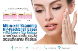 More-xel Scanning RF-Fractional Laser + CO2 Laser + Skin Analyzer เลเซอร์ดูแลแผลเป็น หลุมสิว รอยแตกลาย คีลอยด์