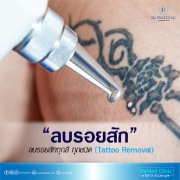 รักษารอยแผลเป็นด้วยนวัตกรรม Picosecond Laser หมดปัญหาผิวไม่เรียบ ไม่สวยจากรอยแผลเป็น หลุมสิว หรือรอยแผลทุกชนิด