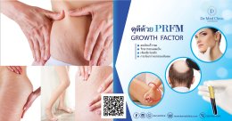 ดูแลรักษา รอยแตกลาย ผิวแตกลาย ด้วย Premium PRFM Platelet-Rich Fibrin Matrix Cell Therapy
