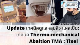 Update from IMCAS เทคนิครักษาหลุมสิว แผลเป็น ริ้วรอย: Tixel เทคนิค Thermo-mechanical Abaltion TMA