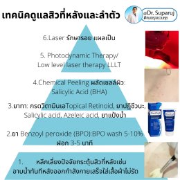 การรักษาเสริม: การรักษาเสริมด้วยหัตถการต่างๆ