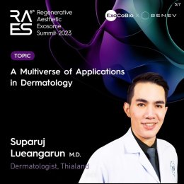 "แนะนำเทคนิคดูแลผิวหลังรักษาหลุมสิวด้วยเลเซอร์ครับIntroducing Techniques for Caring for and Treating Acne Scars with Laser"