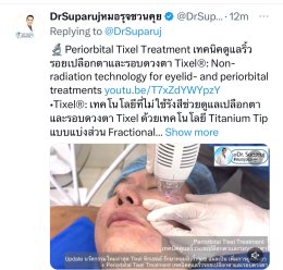 แนะนำเทคนิครักษาหลุมสิวและสิวอักเสบ: ประเมินชนิดความรุนแรงหลุมสิว + เทคโนโลยี Tixel ทิกเซล+ Exosomes
