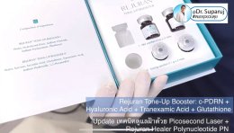 Update เทคนิคดูแลฝ้า จุดด่างดำด้วย Picosecond Laser + Rejuran Tone Up Booster รีจูรันโทนอัฟบูสเตอร์