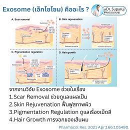 Exosomes มีบทบาทและกลไกในการดูแลฝ้า หรือไม่ & กลไกลเป็นอย่างไร ?