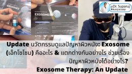 แนะนำเทคนิคในการดูแลหลุมสิว: Exosome ใน การรักษาหลุมสิว (Exosome & acne scar treatment)