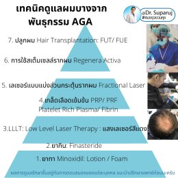 แนะนำเทคนิคดูแลรักษาผมร่วงผมบาง: ยารักษาผมร่วงผมบางมีอะไรบ้างและเลือกใช้อย่างไร?