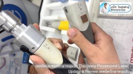 Update & Review เทคนิครักษาหลุมสิว (Acne Scar Treatment: Update & Review)
