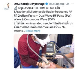 แนะนำเทคนิคดูแลแผลเป็นหลุมสิวด้วย SYLFIRM X Plus + Exosomes (SYLFIRM X Plus & Exosomes for Acne Scar Treatment)