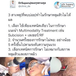 มีปัญหาหลุมสิว แต่ยังมีสิวขึ้นอยู่ สามารถรักษาหลุมสิวได้เลยไหม หรือควรดูแลอย่างไร?