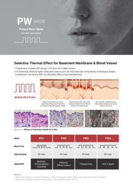 แนะนำนวัตกรรม SYLFIRM X Fractional Radiofrequency Microneedle ช่วยดูแลหลุมสิว ฝ้าเส้นเลือด ริ้วรอย ตัวช่วยปัญหาผิวจากประเทศสหรัฐอเมริกา