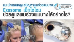 แนะนำเทคนิคดูแลปัญหาผมร่วงผมบาง: ASCE+™ HRLV Exosome เอเอสซีอีเอ็กโซโซม ช่วยดูแลผมร่วงผมบางได้อย่างไร? (ASCE+™ HRLV Exosome Therapy for Hair Loss)
