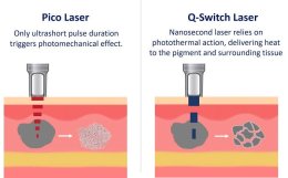 Picosecond Laser เทคโนโลยีพลังงานสูงในช่วงระยะเวลาที่สั้นมากช่วยทำลายเม็ดสีได้อย่างมีประสิทธิภาพ โดยส่งผลต่อเนื้อเยื่อข้างเคียงน้อยมาก
