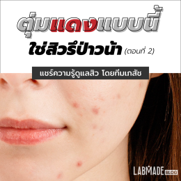 ตุ่มแดงๆแบบนี้ ใช่สิวรึป่าวน้า….? (ตอนที่ 2)