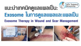 แนะนำเทคนิคดูแลแผลเป็น: Exosome ในการดูแลแผลและแผลเป็น Exosome Therapy in Wound and Scar Management