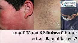  ขนคุดที่มีสีแดง KP Rubra มีลักษณะอย่างไร & ดูแลได้อย่างไร?