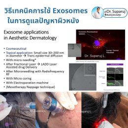 Exosomes มีบทบาทและกลไกในการดูแลฝ้า หรือไม่ & กลไกลเป็นอย่างไร ?