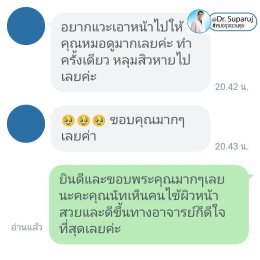 Update รักษาหลุมสิวด้วยเทคนิคการตัดพังผืด Blunt Blade Subcision (Blunt Blade Subcision for Acne Scar Fibrosis Treatment)