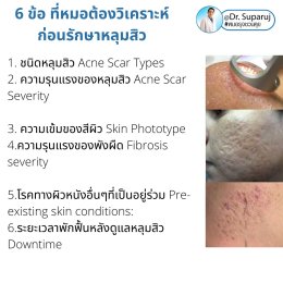 เทคนิคการประเมินตรวจหลุมสิวก่อนการรักษา Acne Scar Evaluation & Assessment