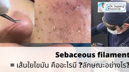 Sebaceous filament = เส้นใยไขมัน คืออะไรมี ?ลักษณะอย่างไร ? ดูแลได้อย่างไร? (คลิปเต็ม Full Clip YouTube Facebook: Dr. Suparuj ครับ